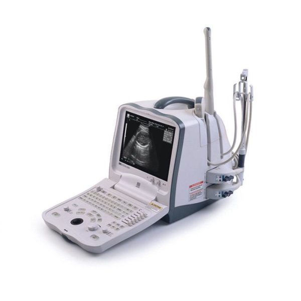 Mindray DigiPrince Ultrasound System