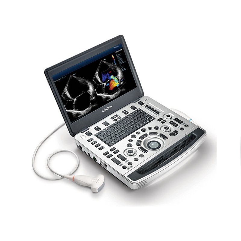 Shop Ultrasound Machines - Ultrasound Supply