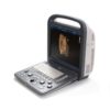 SonoScape S2 Ultrasound Machine